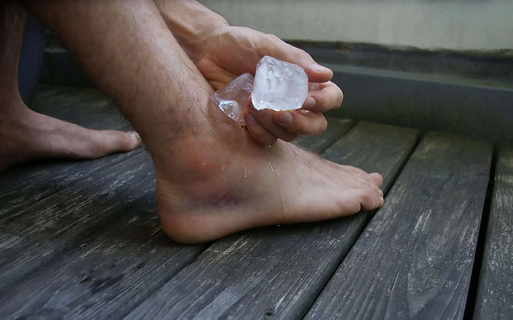 Person applying ice to a swollen and bruised ankle for injury relief.